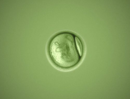 KAKO IZGLEDA ASPIRACIJA JAJNIH ĆELIJA