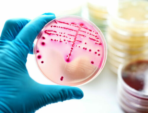 MIKOPLAZMA I UREAPLAZMA