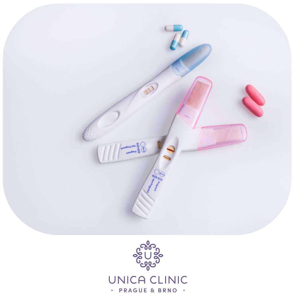 Unica. – Koje su moje opcije